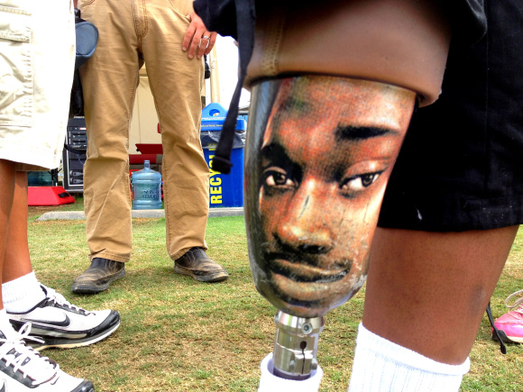 A young Skins fan has RG3's face on his leg.