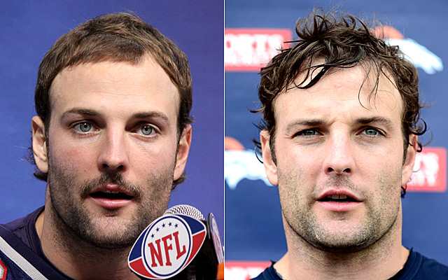 LOOK: Broncos WR Wes Welker embraces hair transplant surgery - CBSSports.com